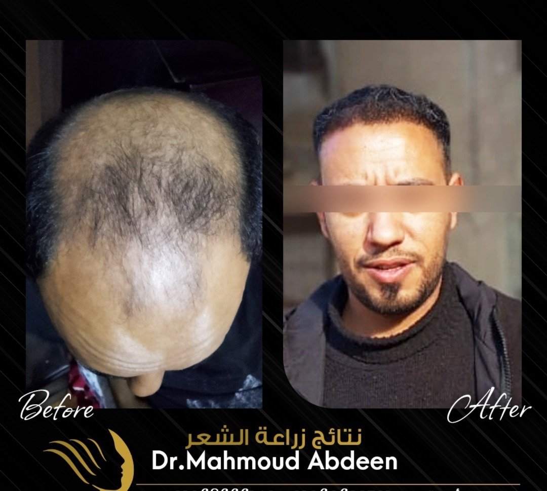 WhatsApp Image 2026-01-27 at 5.18.47 PM (1)