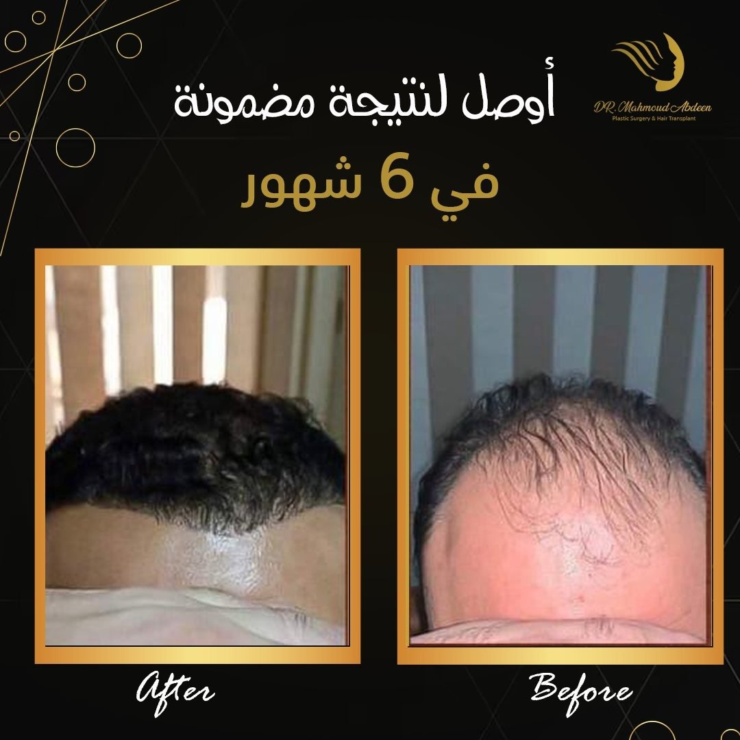 WhatsApp Image 2026-01-27 at 5.18.47 PM